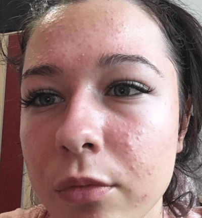Martina — PŘED a PO 1
